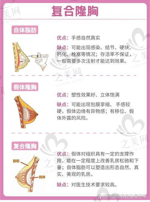 国内隆胸医院排名前五揭晓!多家优质公立强院上榜,为你的变美之路提供可靠选择