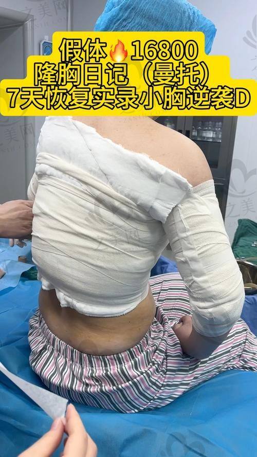 北京十大丰胸医生排行榜翻新