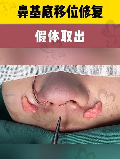 隆鼻整形医院的骨干医生团队实力对比