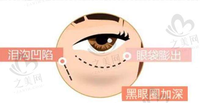 珠海韩妃医疗美容门诊部口碑咋样?我打他家玻尿酸的亲身体验来给大家说道说道