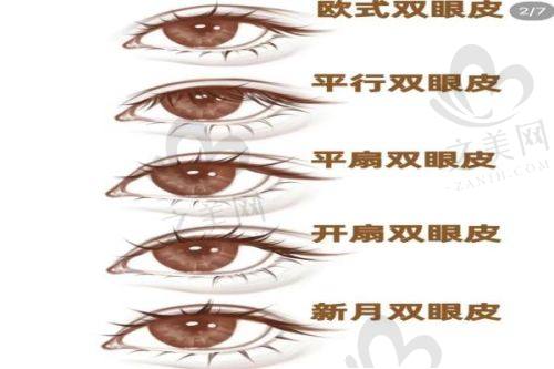 擅长眼部整形骨干医生的收费标准是多少