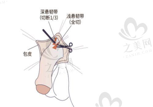 眼修复骨干医生的收费标准和预约方式
