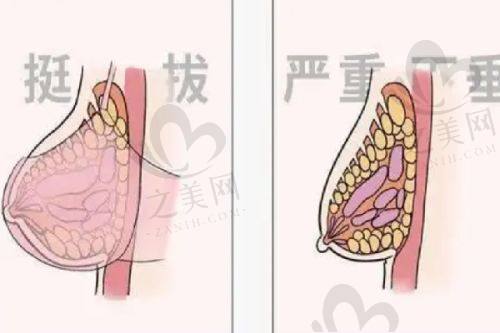 隆鼻整形手术医院的成功实例多吗