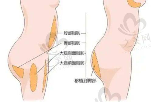 双美胶原蛋白注射体验