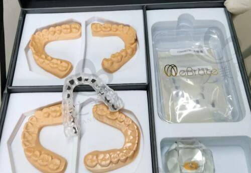 做眼部整形医院的价格收费标准明细