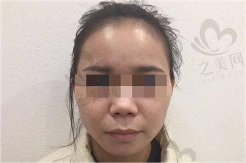 胸部整形三等甲医院的医生团队介绍