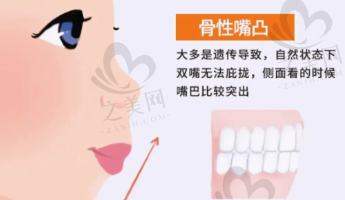 2980元种植牙的质量保护