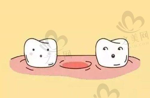 双11前东莞牙科医院各项目看牙价格