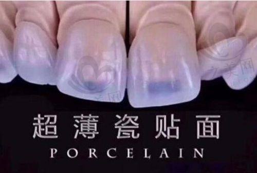 昆明口碑好的口腔医院推荐