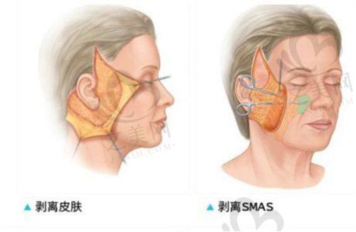医院的医生团队实力