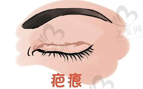 北京和郑州京城皮肤医院祛胎记祛痣的可靠性