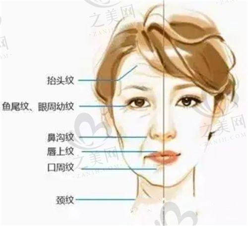南通康美美容医院注射材料优势
