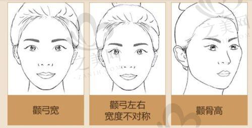 黄金媚眼(眼部黄金微针)体验
