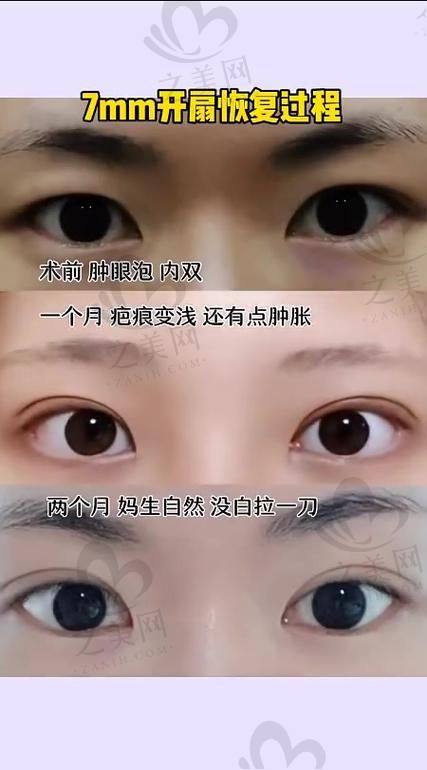 邵阳格莱美眼综合价格情况
