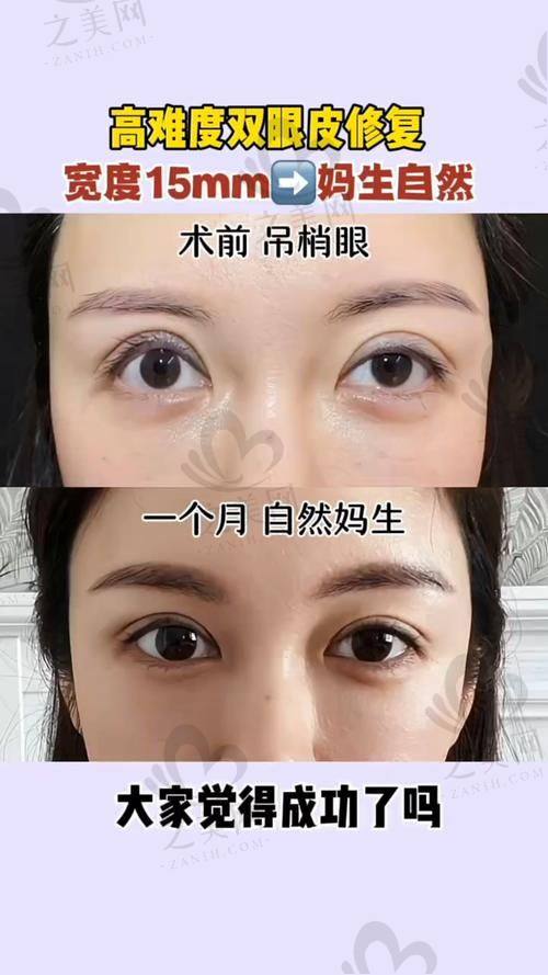 术前沟通与设计