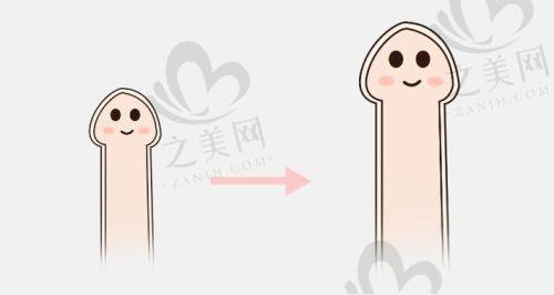 重庆星荣整形医院擅长男性私密延长增粗