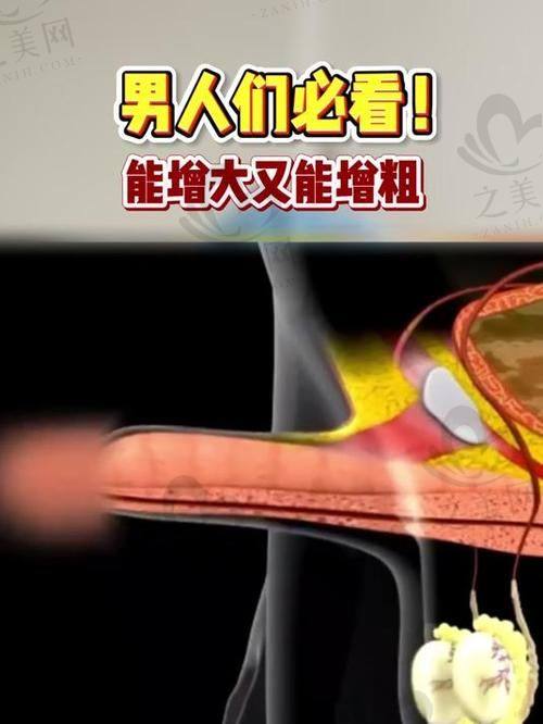 常见男科问题及解决办法