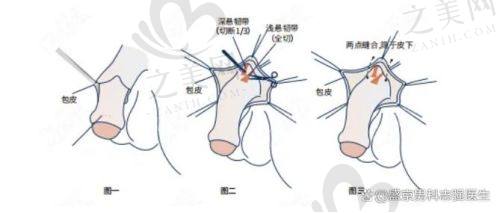 重庆星荣整形院长李世荣个人资料,擅长男性阴茎延长增粗手术,了解坐诊医院及挂号情况