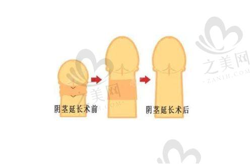 手术功效实例