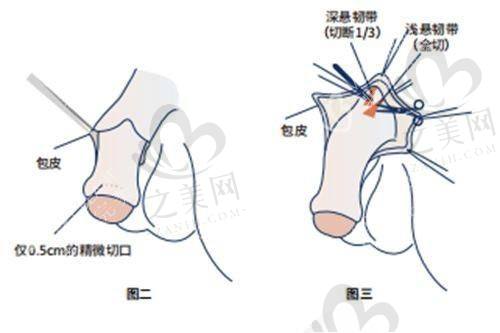 24小时免费男科医生在线询问优势