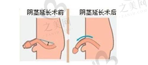 有名男科医生介绍