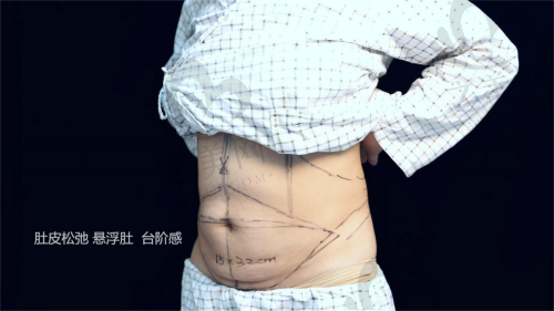 手术疗效与收费情况