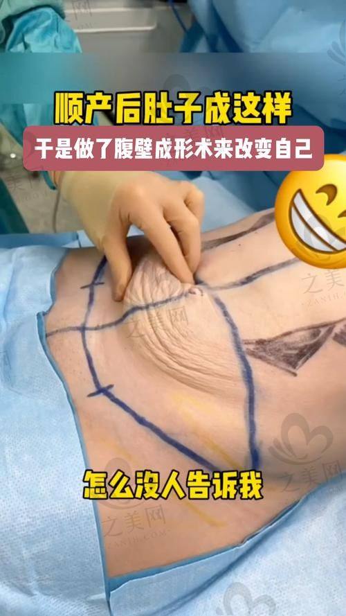 手术感受之直立行走与侧睡