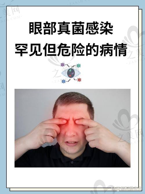 更好的眼科整形医院的价格收费情况