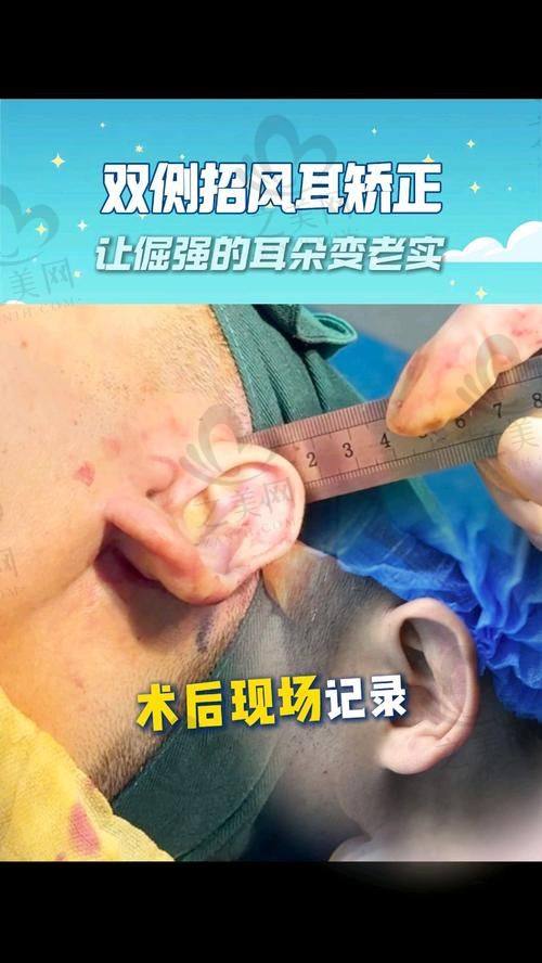 术后护理情况