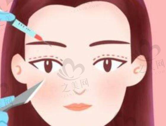 北京八大处、上海九院等眼整形好医院排名口碑、专家团队、成功案例、特色技术及价格全揭秘
