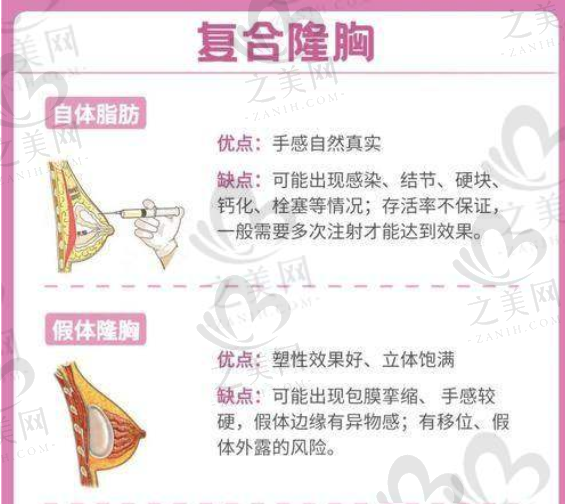 广州胸部整形医生朱云:坐诊中家医家庭医生整形医院,口碑好技术多,地址在东风东路660号