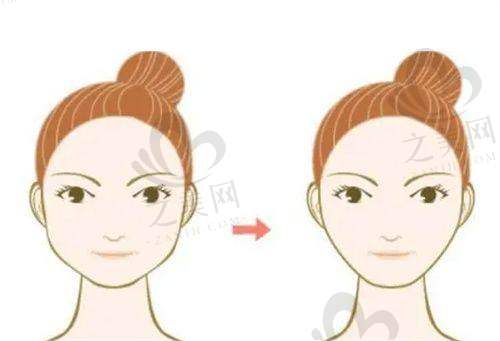 北京东方和谐冯斌医生咋样?纯脂面部吸脂价格多少?冯斌/孙泽芳/张彦春收费有别