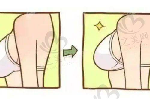适合人群分析