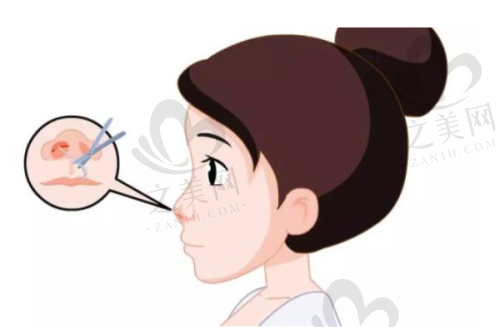 青岛华韩整形医院排名及特色