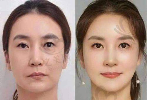 选择医院和医生的注意事项