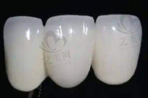 嘉兴英博口腔其他项目价格及分析
