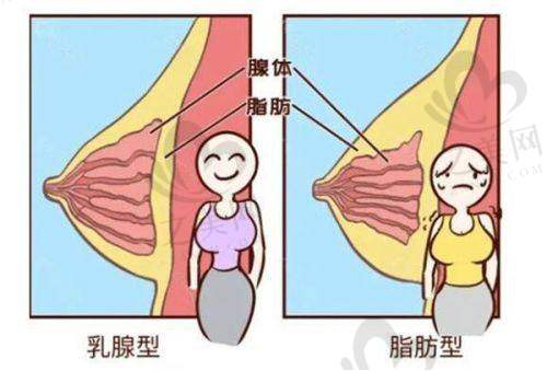 北京艺星医疗整形美容医院杨季涛医生假体丰胸和胸部修复的价格