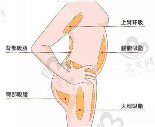 北京艺星医疗整形美容医院杨季涛医生打造舒适波涛胸的优势