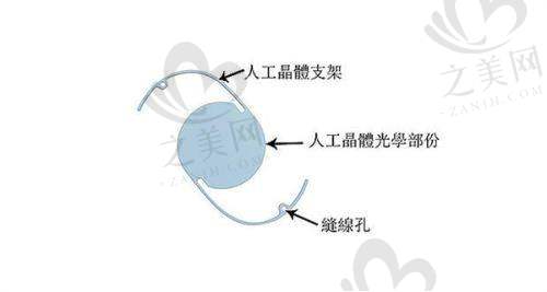 北京艺星医疗整形美容医院杨季涛医生内窥镜技术在丰胸中的应用