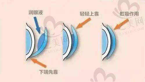 电话预约挂号