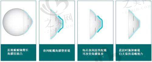 详细预约挂号流程