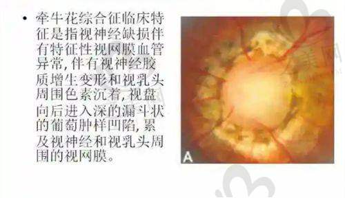 后巩膜加固手术骨干医生坐诊信息