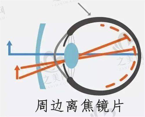 视光中 心配镜情况