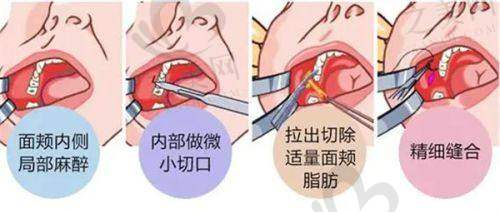 北京艺星医疗整形美容医院杨季涛医生胸部修复实例分享