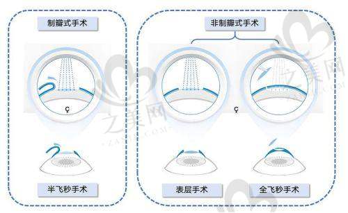 赣州爱尔眼科医院简介