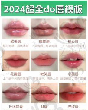 青岛做嘴唇一般花多少钱?唇部整形医院了解下,乔雅登丰颜1毫升15800元起