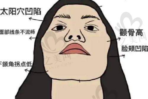 南京医科大学友谊整形外科扬州医美门诊部咋样?营业大技术好,医生隆鼻眼整形都不错