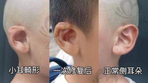 新乡割双眼皮医院情况