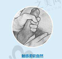 热门项目——双眼皮
