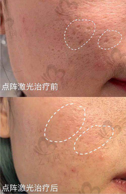 牙齿矫正优势